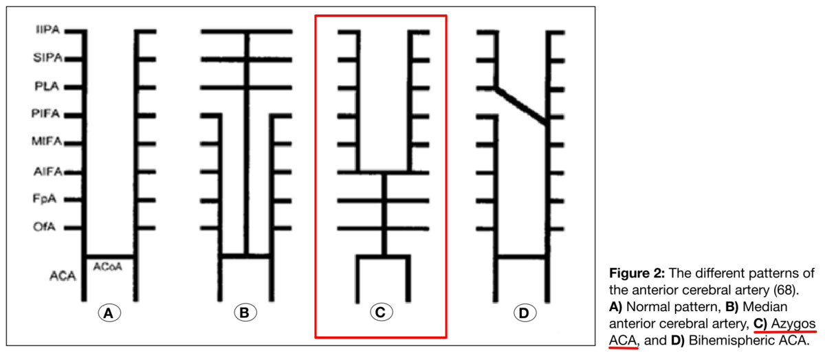 前方循環系の脳卒中で生じた四肢麻痺: 症例～診断｜神経内科の論文学習